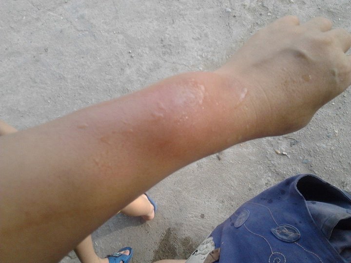 Tran Thi Nga 3