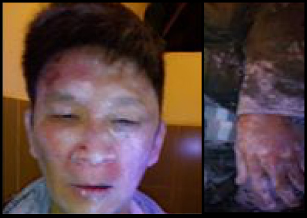 Hình ảnh anh Trương Minh Đức bị đánh ngày 2 tháng 11, 2014 RFA files