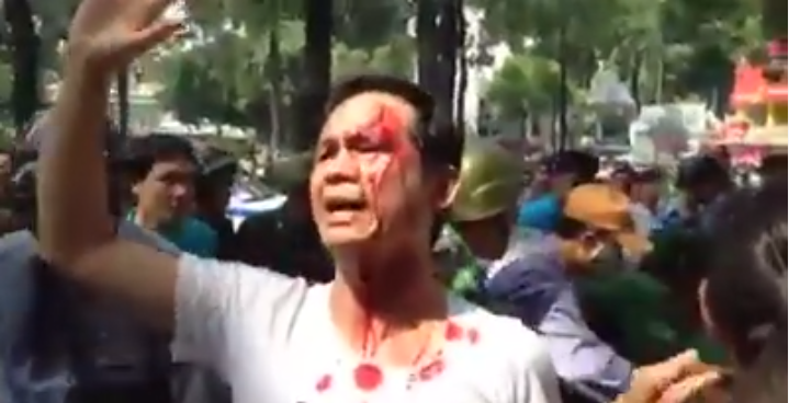 Nhà hoạt động Trần Bang bị an ninh thường phục đánh đổ máu đầu. Ảnh chụp màn hình