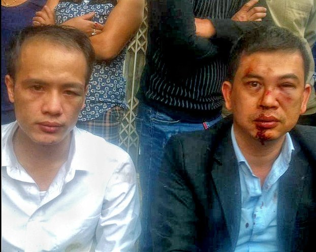 This photo, taken from Facebook, shows two lawyers after they were assaulted in Hanoi on November 3, 2015.