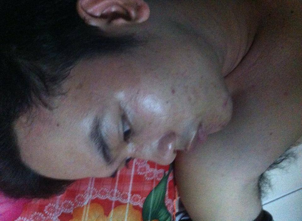 Severely injured Nguyen Cong Thu cannot go to hospital as police gather outside of his house in An Giang province