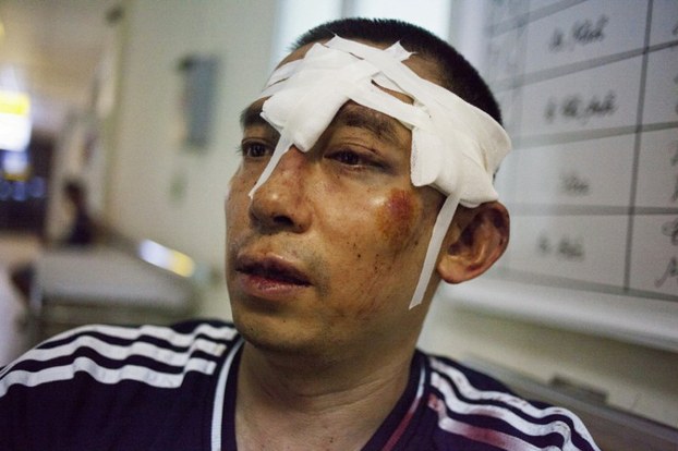 Vietnamese activist La Viet Dung is shown after being beaten by unidentified attackers, July 11, 2016. AFP