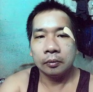 Anh Đỗ Phi Trường bị công an bắt giữ, đánh đập, cáo buộc tội hoạt động đảng phái chính trị.